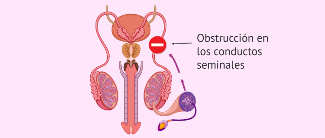 Imagen: Espermatozoides con estructura perfecta