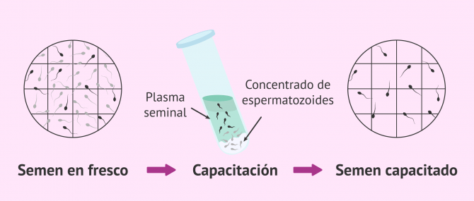 Imagen: Recuento de espermatozoides progresivos