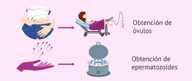 Imagen: Fecundación in vitro con donación de semen