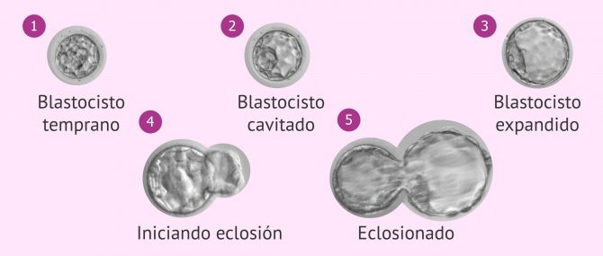 Imagen: Expansión del blastocisto