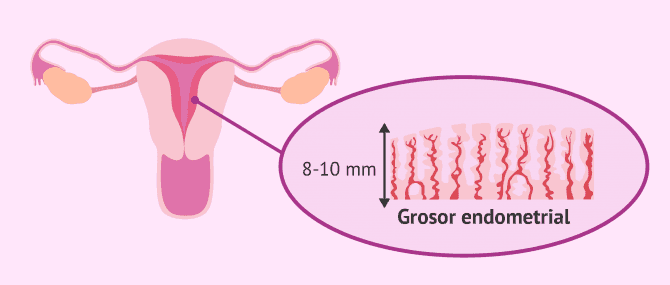 Imagen: Grosor endometrial para favorecer la implantación embrionaria