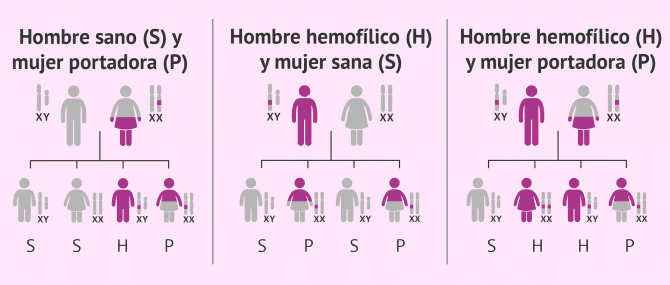 Imagen: Formas de transmitir la hemofilia de padres a hijos