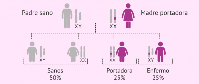 Imagen: Herencia del Síndrome de X Frágil