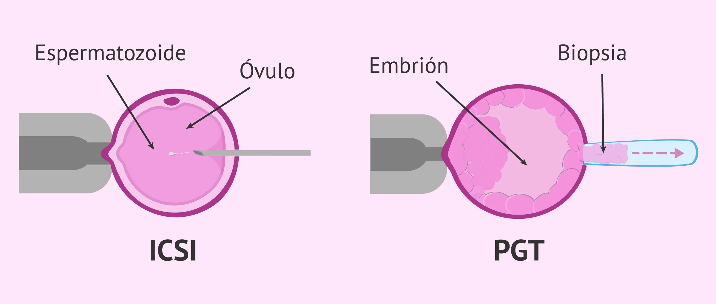 Técnicas complementarias en FIV