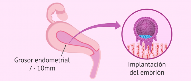 Imagen: Implantación en el endometrio