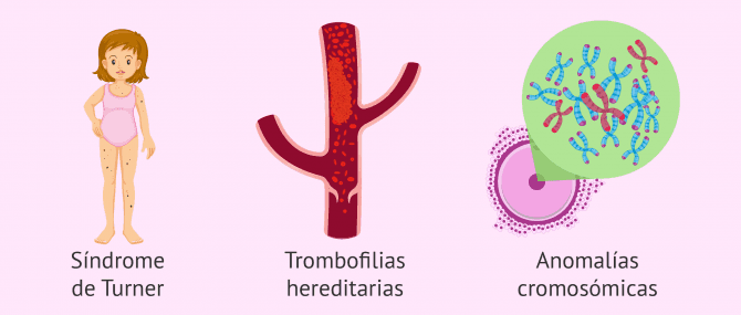 Imagen: Alteraciones genéticas que causan infertilidad en las mujeres