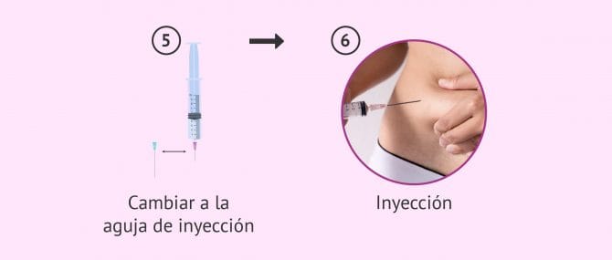 Imagen: ¿Cómo se inyecta Decapeptyl diario?