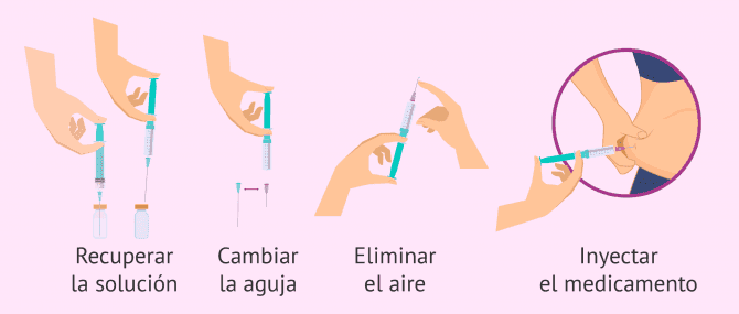 Imagen: ¿Cómo se inyecta Pergoveris?