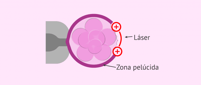 Imagen: Eclosión asistida por láser