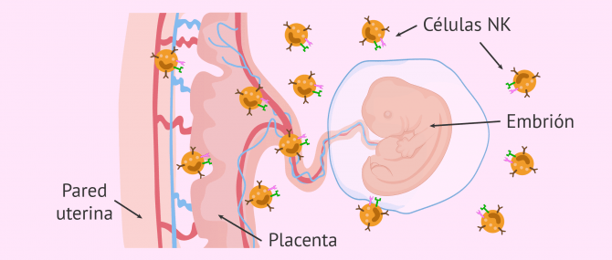 Imagen: Linfocitos que atacan al embrión y causan aborto