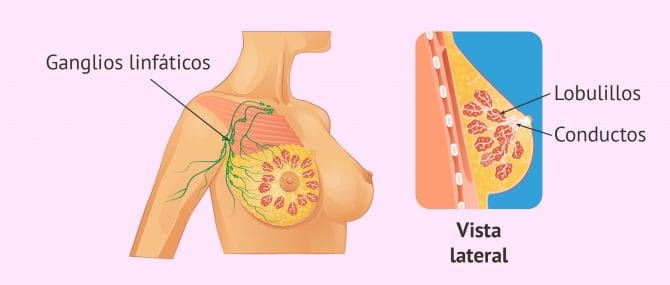 Imagen: Localización del cáncer de mama