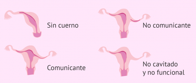 Imagen: Alteraciones uterinas