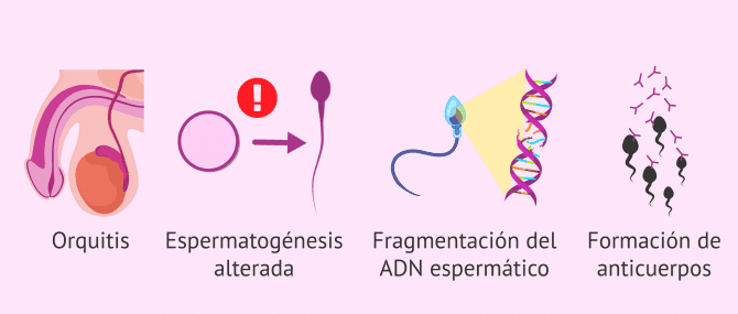 Imagen: Síntomas de las ETS en el hombre