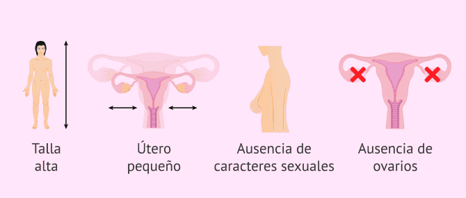 Imagen: Cuadro clínico del síndrome de Swyer