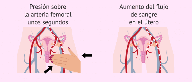 Imagen: Masaje femoral para mejorar el endometrio