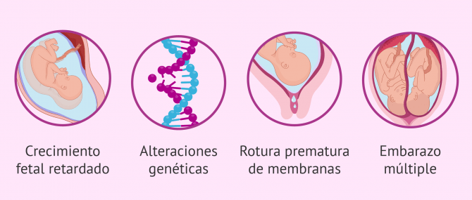 Imagen: Causas fetales de muerte intrauterina