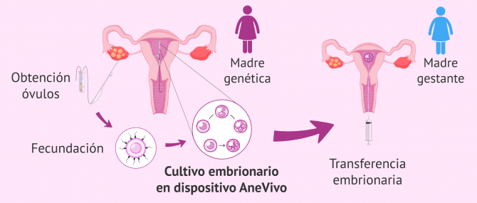 Imagen: AneVivo para maternidad compartida