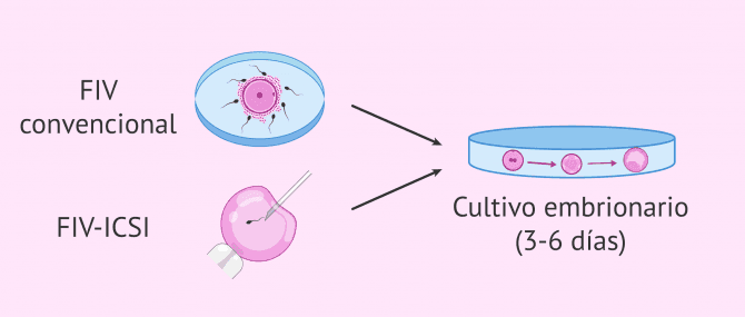 Imagen: Tipos de fecundación y cultivo embrionario