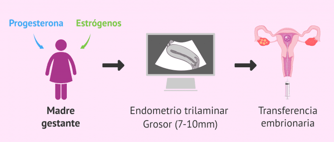 Imagen: Preparación endometrial y transferencia embrionaria