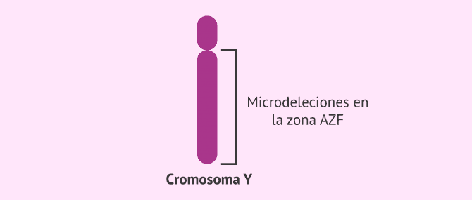 Imagen: Región AZF del cromosoma Y