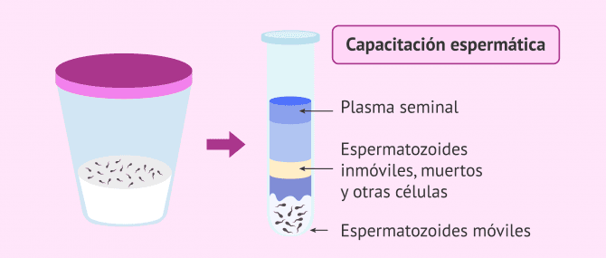 Imagen: Muestra seminal y capacitación espermática