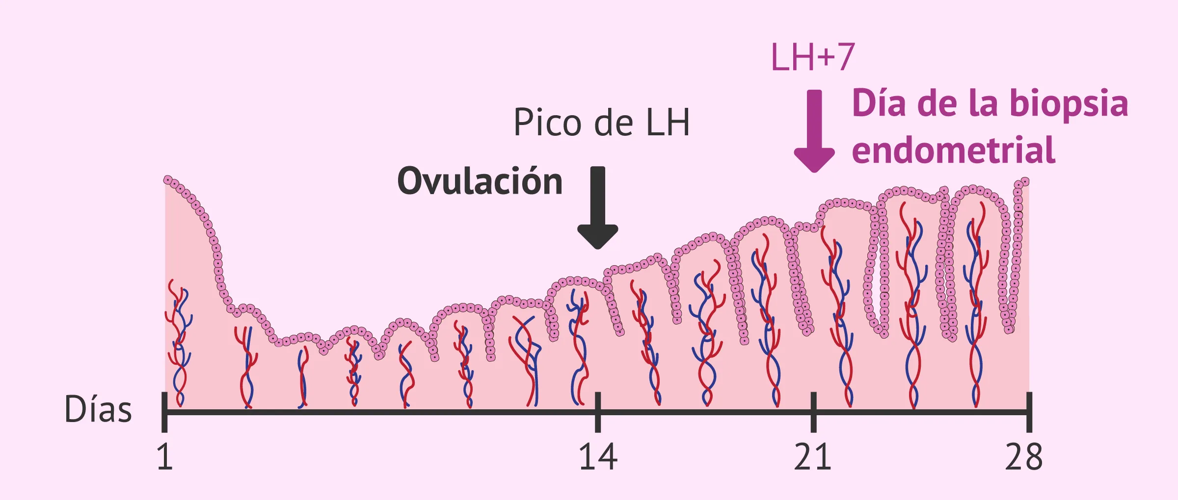 Cuándo obtener la biopsia endometrial para el test ERA