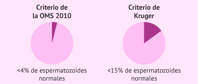 Imagen: Diagnóstico de la teratozoospermia