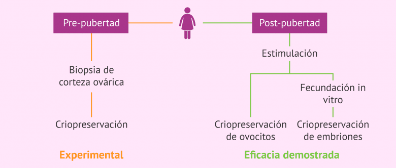 Imagen: Opciones de preservación de la fertilidad en pacientes oncológicas