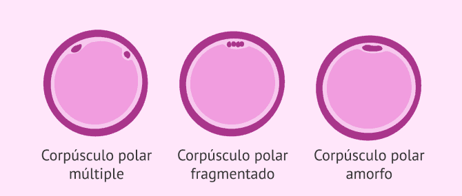 Imagen: Averiguar estado reserva ovárica