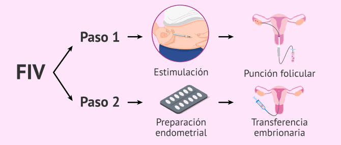 Imagen: Pasos del proceso de FIV