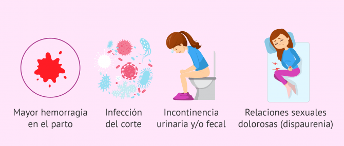 Imagen: Complicaciones de la episiotomía