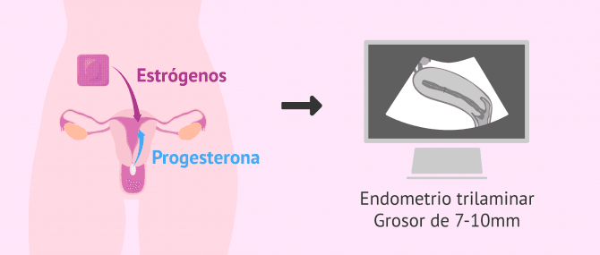 Imagen: Preparación endometrial para transferencia en diferido