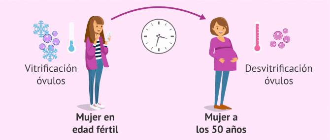 Imagen: Preservación de la fertilidad para retrasar la maternidad