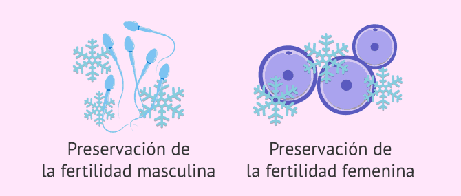 Imagen: Métodos para preservar la fertilidad femenina y masculina