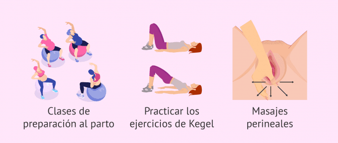 Imagen: Recomendaciones para prevenir la episiotomía