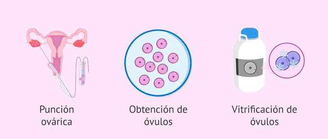 Imagen: Proceso para vitrificar óvulos en el laboratorio