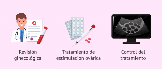 Imagen: Inicio del proceso para la preservación de la fertilidad