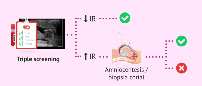 Imagen: Procedimiento del cribado combinado del primer trimestre