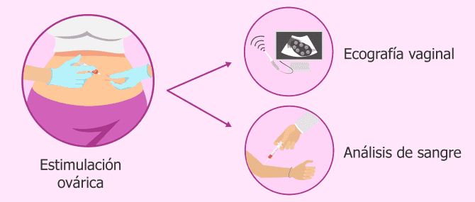 Imagen: Pruebas para estimar el número de óvulos que se obtendrán