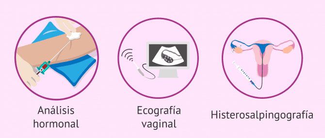 Imagen: Pruebas para estudiar la fertilidad femenina