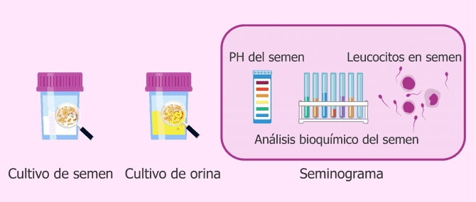 Imagen: Análisis para detectar infecciones seminales