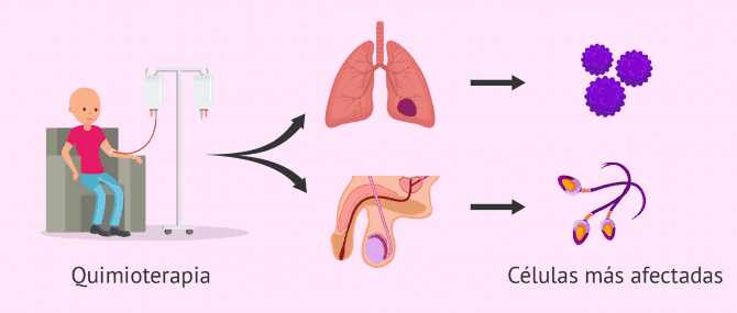 Imagen: Quimioterapia e infertilidad masculina