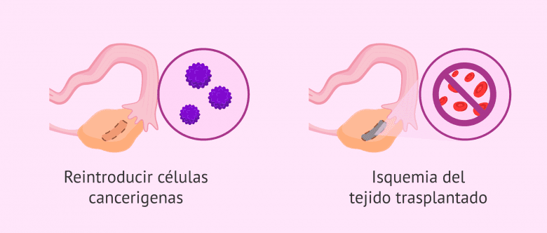 Imagen: Limitaciones del trasplante de tejido ovárico