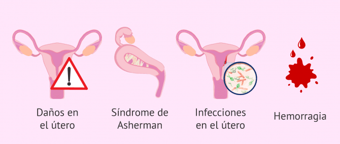 Imagen: Posibles complicaciones del legrado uterino