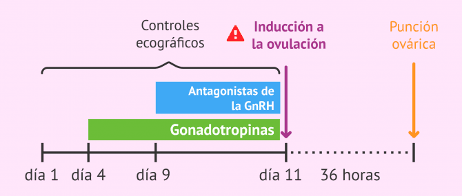 Imagen: Problemas en la administración del 'trigger' en la estimulación ovárica