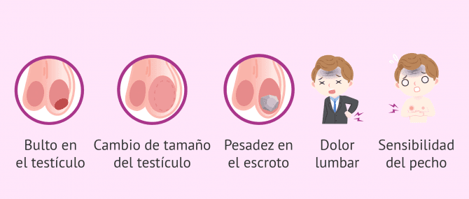 Imagen: Sintomas del cáncer de testiculo