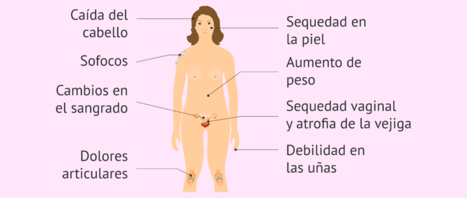 Imagen: Síntomas en el climaterio y la menopausia