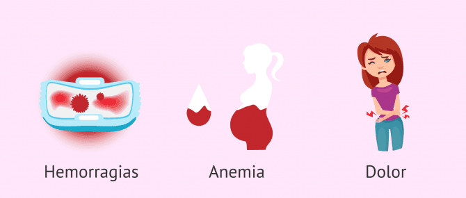 Imagen: Síntomas de los pólipos uterinos