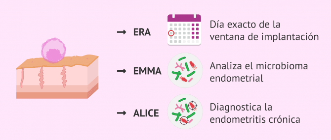 Imagen: Test EndomeTRIO: ERA, EMMA y ALICE