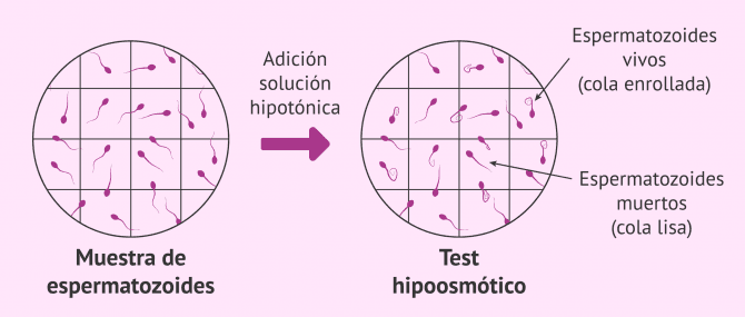 Imagen: Prueba hipoosmótica para el estudio de la vitalidad espermática